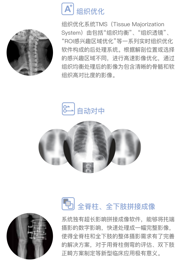 【康达】医用数字化X射线摄影系统KD-450A直降6万，仅限2台！