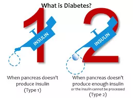 你只知道糖尿病分为1型和2型？其实糖尿病是5种不同的疾病