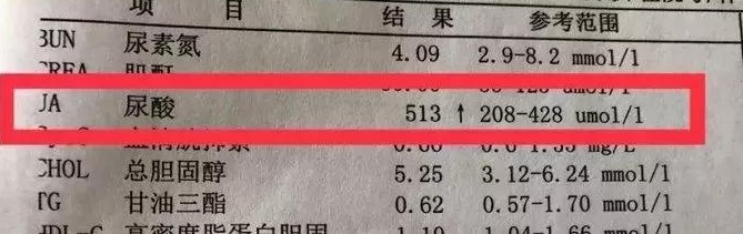 尿酸超标？看这份指南就够了