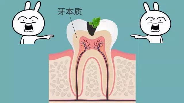 中龋