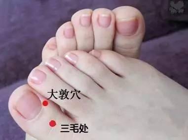 手脚冰凉不是没人疼，而是....办法很简单 | 健康资讯