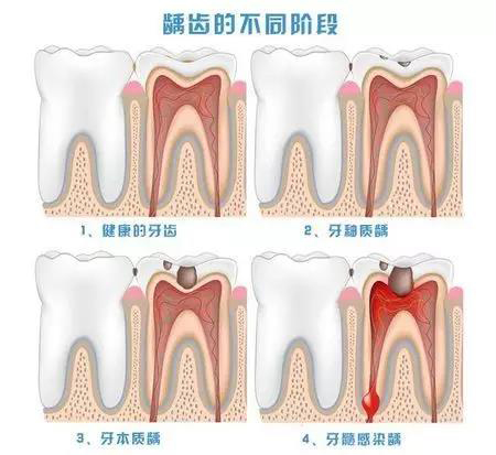 为什么口臭，原因是在这里