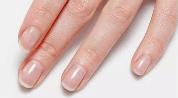 指甲上有白点是怎么回事？ | 健康问答