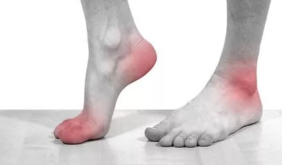 戒了海鲜啤酒，就能远离痛风？ | 健康资讯