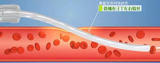 强阻菌易消毒双安全留置针（驼人集团） | 厂商资讯