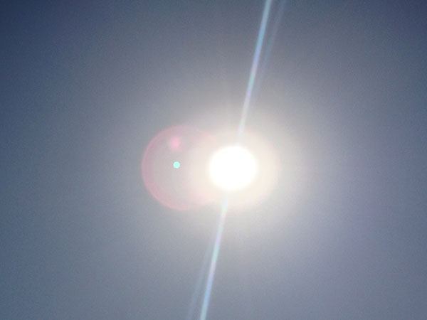 烧烫伤后康复病人要怎么度过夏天？ | 健康问答