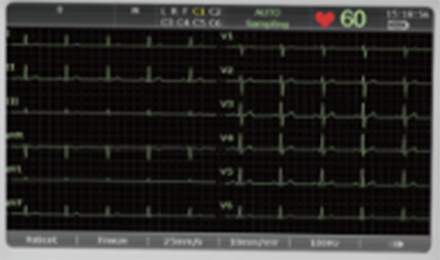 事实证明，心电图机还是要找操作简单、性能卓越的！