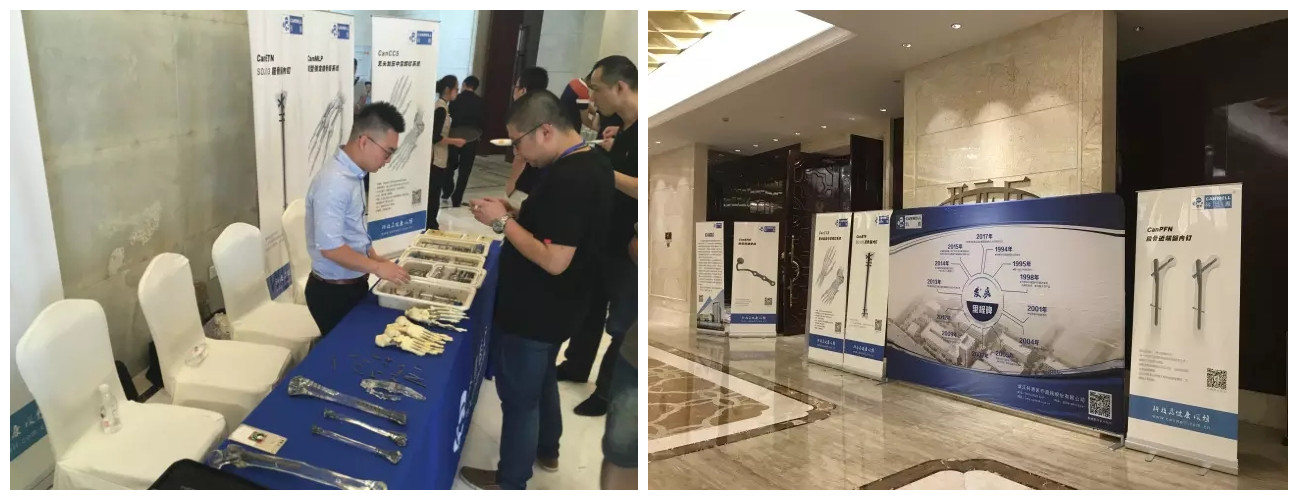 科惠医疗成功参办2017华夏骨科足踝外科专科教育活动 | 厂商资讯