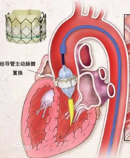 心脏的“阀门”原来是这么“工作”！