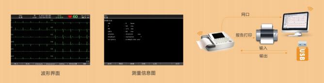 事实证明，心电图机还是要找操作简单、性能卓越的！