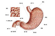 从胃炎到胃癌，仅仅只有4步！ | 健康资讯