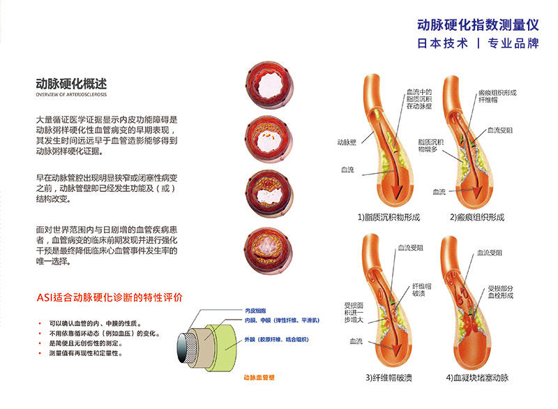 动脉硬化指数测量仪