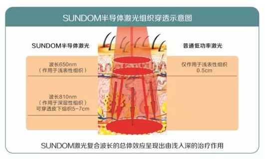 买半导体激光治疗机，你最最最最关心啥？