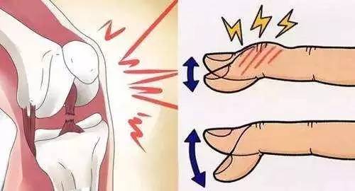 关节咔咔响是一种病吗？ | 医学科普
